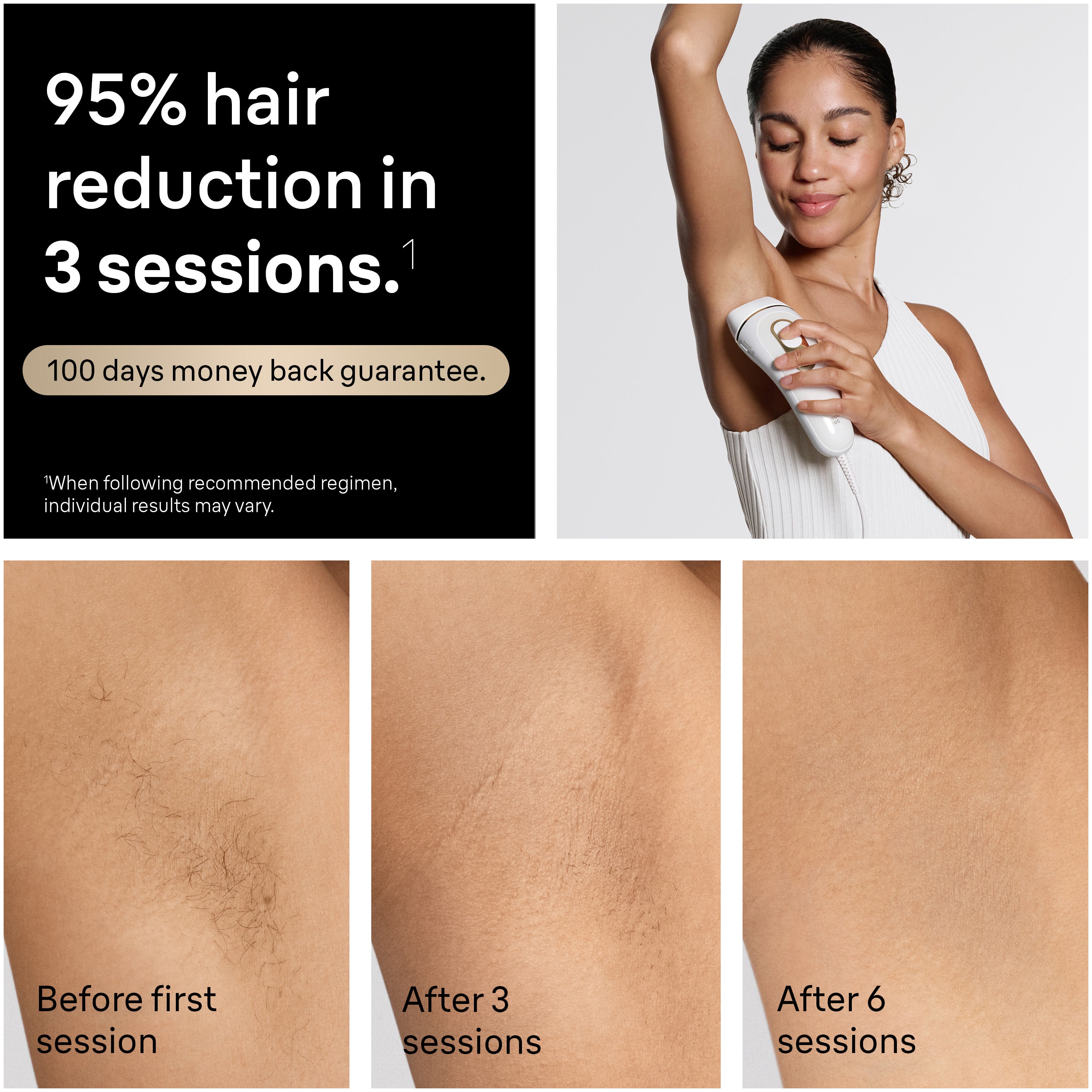 Braun Smart IPL Silk·Expert Pro 5: At Home Alternative to Laser Hair Removal with 4 Caps Facial Hair Trimmer and Vanity Case IPL5442