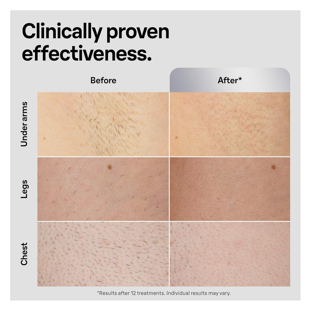 Braun Smart IPL Silk·Expert Pro 5: At Home Alternative to Laser Hair Removal with Wide Cap and Leather Pouch IPL5145