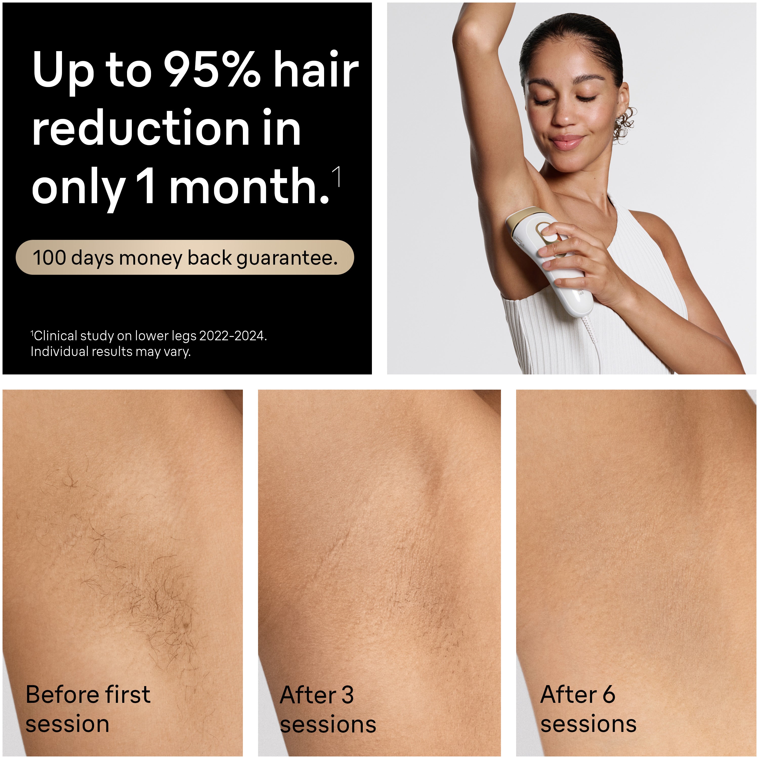 Braun Smart IPL Silk·Expert Pro 5: At Home Alternative to Laser Hair Removal with 2 Caps and Leather Pouch IPL5137